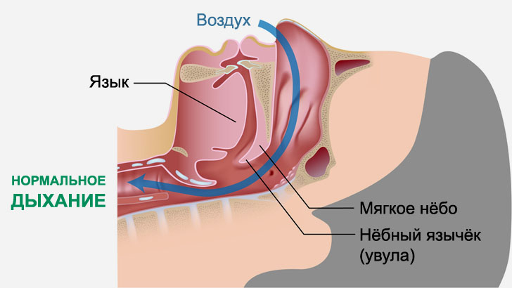 Храп, как предвестник апноэ