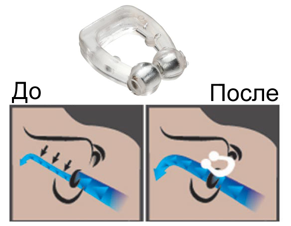 Устройство от Маирс